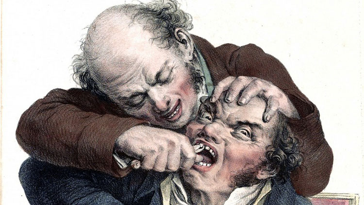 Dessin d'un pseudo-dentiste en train d'arracher la dent d'un homme avec une tenaille.